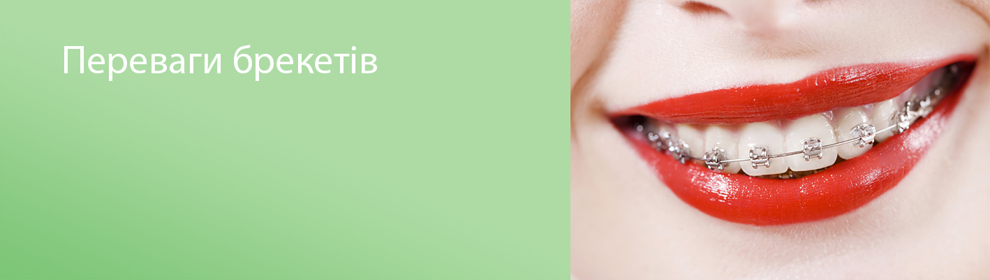 лікування брекетами
