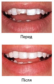 косметична реставрація